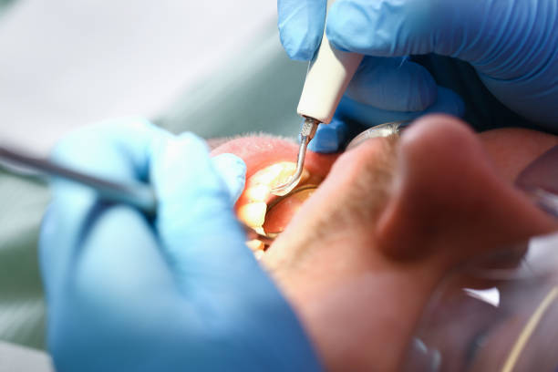 Best Emergency Tooth Extraction  in Argos, IN