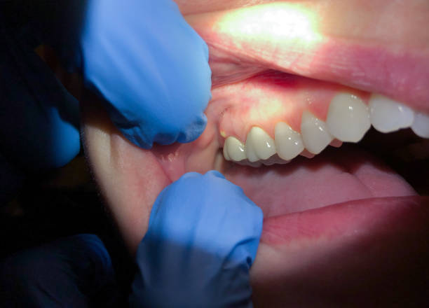 Emergency Gum Pain Relief in IN