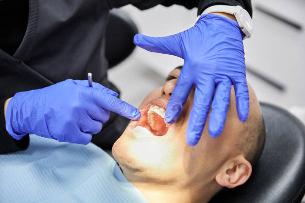 Best Knocked-Out Tooth Emergency  in Argos, IN
