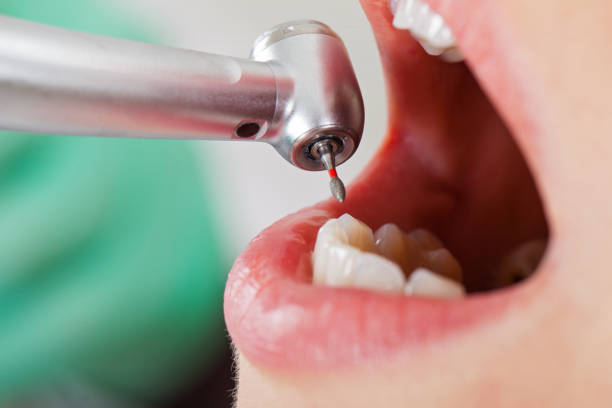Best Cracked Tooth Emergency Dentist  in Argos, IN